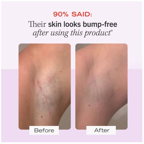 First Aid Beauty Skincare New Unopened First Aid Beauty Ingrown